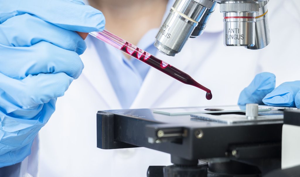Teste molecular rápido por RT-PCR (GeneXpert)